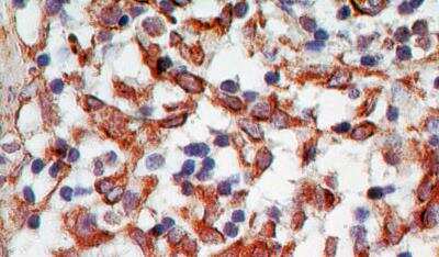 Immunohistochemistry-Paraffin: TRANCE/TNFSF11/RANK L Antibody (12A668) - Azide Free [NB100-56593] - Formalin-fixed, paraffin-embedded human lymph node probed with Trance antibody at 5 ug/ml.    Staining of formalin-fixed tissues is enhanced by boiling tissue sections in 10 mM sodium citrate buffer, pH 6.0 for 10-20 min followed by cooling at RT for 20 min.