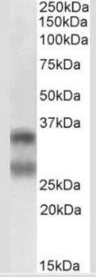 Western Blot: TRANCE/TNFSF11/RANK L Antibody (12A668) - Azide Free [NB100-56593] - Analysis of human lymph node lysate (35ug per lane, RIPA buffer) at 0.5ug/ml. Band detected at ~35kDa and ~28kDa. (Expected MW of 35.5kDa according to NP_003692.1 and of 27.7kDa according to NP_143026.1)