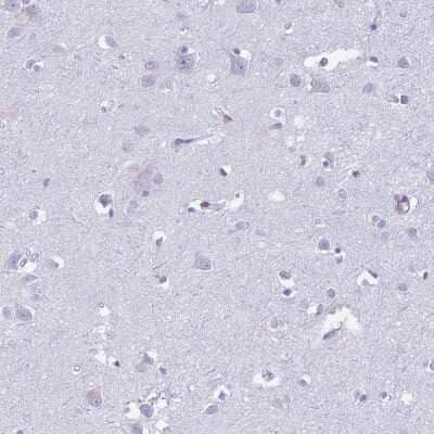Immunohistochemistry-Paraffin: TRANCE/TNFSF11/RANK L Antibody [NBP2-47599] - Staining of human cerebral cortex shows low expression as expected.