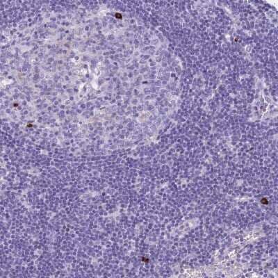 Immunohistochemistry-Paraffin: TRANCE/TNFSF11/RANK L Antibody [NBP2-47599] - Staining of human lymph node shows high expression.