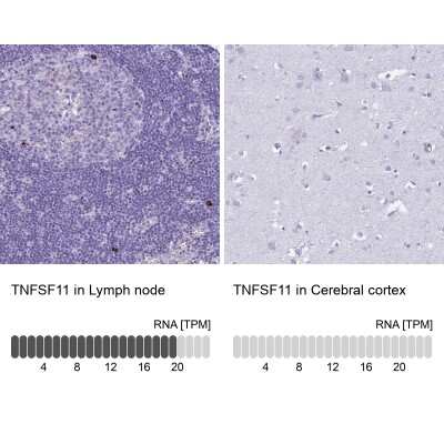 Immunohistochemistry-Paraffin: TRANCE/TNFSF11/RANK L Antibody [NBP2-47599] - Staining in human lymph node and cerebral cortex tissues using anti-TNFSF11 antibody. Corresponding TNFSF11 RNA-seq data are presented for the same tissues.