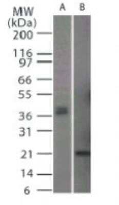 Western Blot: TRANCE/TNFSF11/RANK L Antibody [NB100-56388] - Analysis of CD254 using NB100-56388. RAW lysate (A) and partial His-tagged recombinant protein (B) probed at 2 ug/ml.