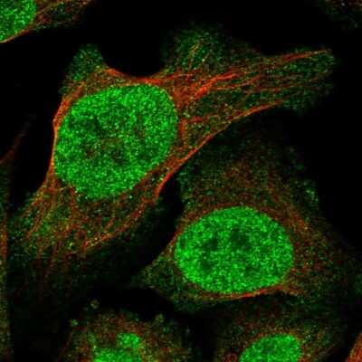 Immunocytochemistry/Immunofluorescence: TRANK1 Antibody [NBP1-93641] - Staining of human cell line U-2 OS shows localization to nucleoplasm. Antibody staining is shown in green.