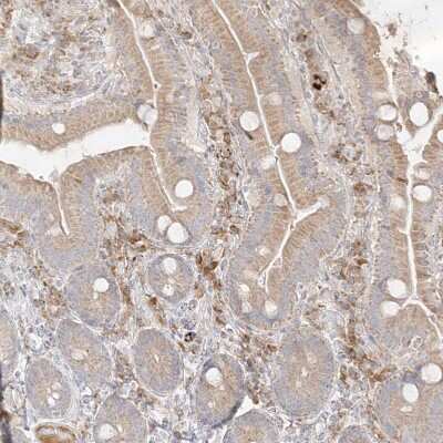 Immunohistochemistry-Paraffin: TRANK1 Antibody [NBP1-93641] - Staining of human duodenum shows moderate cytoplasmic positivity in lymphoid cells.