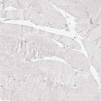 Immunohistochemistry-Paraffin: TRANK1 Antibody [NBP1-93641] - Staining of human skeletal muscle shows no positivity in myocytes as expected.