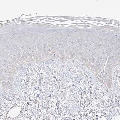 Immunohistochemistry-Paraffin: TRANK1 Antibody [NBP1-93641] - Staining of human skin shows no positivity in squamous epithelial cells as expected.