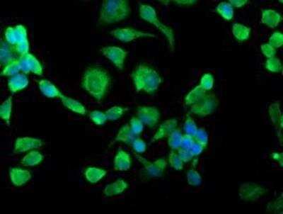 Immunocytochemistry/Immunofluorescence: TRAP alpha Antibody (4C7) [NBP2-01026] - Immunofluorescent staining of HeLa cells using anti-TRAP alpha mouse monoclonal antibody.