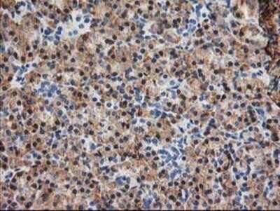Immunohistochemistry: TRAP alpha Antibody (OTI4C7) - Azide and BSA Free [NBP2-74591] - Staining of paraffin-embedded Human pancreas tissue using anti-TRAP alpha mouse monoclonal antibody.