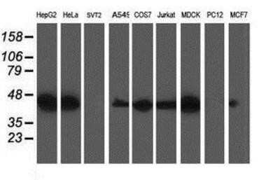 Western Blot: TRAP alpha Antibody (OTI4C7) - Azide and BSA Free [NBP2-74591] - Analysis of extracts (35ug) from 9 different cell lines by using anti-TRAP alpha monoclonal antibody.