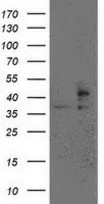Western Blot: TRAP alpha Antibody (OTI4C7) - Azide and BSA Free [NBP2-74591] - HEK293T cells were transfected with the pCMV6-ENTRY control (Left lane) or pCMV6-ENTRY TRAP alpha (Right lane) cDNA for 48 hrs and lysed. Equivalent amounts of cell lysates (5 ug per lane) were separated by SDS-PAGE and immunoblotted with anti-TRAP alpha.
