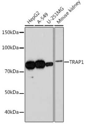 Western Blot: TRAP1 Antibody (1L8C1) [NBP3-16303] - Western blot analysis of extracts of various cell lines, using TRAP1 Rabbit mAb (NBP3-16303) at 1:1000 dilution. Secondary antibody: HRP Goat Anti-Rabbit IgG (H+L) at 1:10000 dilution. Lysates/proteins: 25ug per lane. Blocking buffer: 3% nonfat dry milk in TBST. Detection: ECL Basic Kit. Exposure time: 3min.