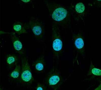 Immunocytochemistry/Immunofluorescence: TRAP1 Antibody (3H4-2H6) [NBP2-59343] - Tissue: Myoblast cell line C2C12 . Species: Mouse. Fixation: 4% Formaldehyde for 15 min at RT. Primary Antibody: Mouse Anti-Trap1 Monoclonal Antibody at 1:100 for 60 min at RT. Secondary Antibody: Goat Anti-Mouse ATTO 488 at 1:100 for 60 min at RT. Counterstain: DAPI (blue) nuclear stain at 1:5000 for 5 min RT. Localization: Nucleus. Magnification: 60X.