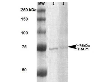 Western Blot: TRAP1 Antibody (3H4-2H6) [NBP2-59343] - Analysis of Human, Rat Human A431 and Rat Brain Membrane cell lysates showing detection of ~75 kDa Trap1 protein using Mouse Anti-Trap1 Monoclonal Antibody, Clone 3H4-2H6.  Lane 1: MW ladder. Lane 2: Human lysate, A431. Lane 3: Rat lysate, Rat Brain Membrane (RBM). Load: 20 ug. Block: 5% milk + TBST for 1 hour at RT. Primary Antibody: Mouse Anti-Trap1 Monoclonal Antibody at 1:1000 for 1 hour at RT. Secondary Antibody: HRP Goat Anti-Rabbit at 1:2000 for 1 hour at RT. Color Development: TMB solution for 15 min at RT. Predicted/Observed Size: ~75 kDa.