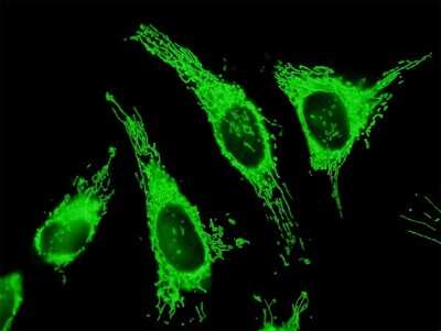 Immunocytochemistry/Immunofluorescence: TRAP1 Antibody [H00010131-B01P] - Analysis of purified antibody to TRAP1 on HeLa cell. (antibody concentration 10 ug/ml)