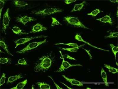 Immunocytochemistry/Immunofluorescence: TRAP1 Antibody [H00010131-D01P] - Analysis of antibody to TRAP1 on HeLa cell. Antibody concentration 10 ug/ml.