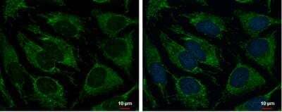 <b>Genetic Strategies Validation. </b>Immunocytochemistry/Immunofluorescence: TRAP1 Antibody [NBP2-20700] - HeLa cells were fixed in 2% paraformaldehyde/culture medium at 37oC for 30 min and permeabilized with 100% MeOH for 30 sec. Green: TRAP1 protein stained by TRAP1 antibody [N1N3] diluted at 1:500. Blue: Hoechst 33342 staining. Scale bar = 10 um.