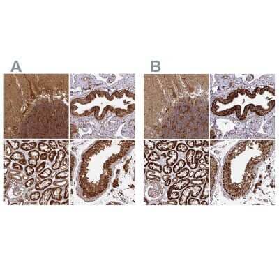 Immunohistochemistry-Paraffin: TRAP1 Antibody [NBP2-47597] - Staining of human cerebellum, fallopian tube, kidney and testis using Anti-TRAP1 antibody NBP2-47597 (A) shows similar protein distribution across tissues to independent antibody NBP2-47598 (B).