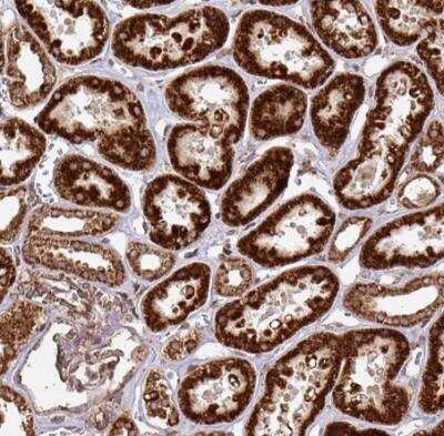 Immunohistochemistry-Paraffin: TRAP1 Antibody [NBP2-47597] - Staining of human kidney shows strong to very strong granular cytoplasmic positivity in cells in tubules.