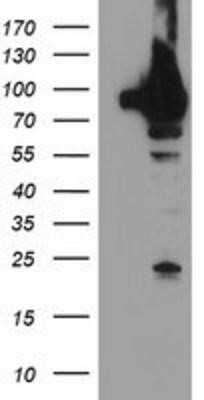Western Blot: TRAP1 Antibody (OTI1H8) - Azide and BSA Free [NBP2-74592] - HEK293T cells were transfected with the pCMV6-ENTRY control (Left lane) or pCMV6-ENTRY TRAP1 (Right lane) cDNA for 48 hrs and lysed. Equivalent amounts of cell lysates (5 ug per lane) were separated by SDS-PAGE and immunoblotted with anti-TRAP1.
