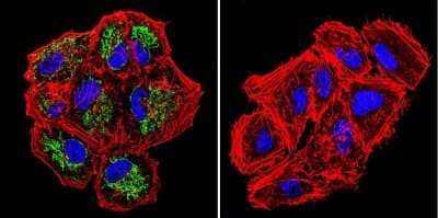 Immunocytochemistry/Immunofluorescence: TRAP1 Antibody (TRAP1-6) [NB300-555] - Analysis of TRAP1 in NCI-H460 Cells. Cells were grown on chamber slides and fixed with formaldehyde prior to staining. Cells were probed without (control) or with a TRAP1 monoclonal antibody at a dilution of 1:200 overnight at 4C, washed with PBS and incubated with a DyLight-488 conjugated secondary antibody. TRAP1 staining (green), F-Actin staining with Phalloidin (red) and nuclei with DAPI (blue) is shown.