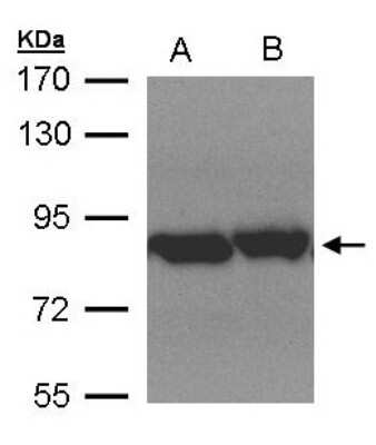 Western Blot: TRAP1 Antibody [NBP1-32097] - Sample(30 ug of whole cell lysate)A:Hep G2 B:MOLT4 7. 5% SDS PAGE, antibody diluted at 1:1500.