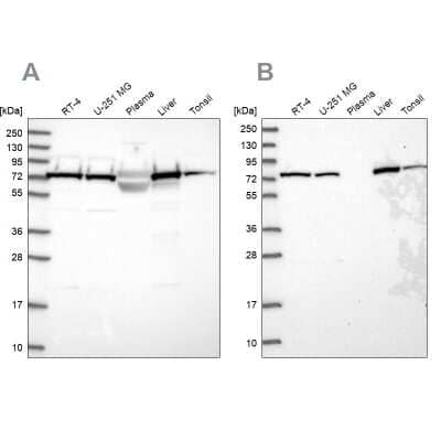 Western Blot: TRAP1 Antibody [NBP2-47598] - Analysis using Anti-TRAP1 antibody NBP2-47598 (A) shows similar pattern to independent antibody NBP2-47597 (B).