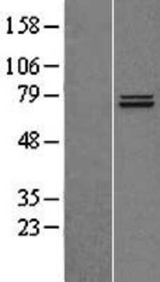 Western Blot: TRAP1 Overexpression Lysate (Adult Normal) [NBL1-17255] Left-Empty vector transfected control cell lysate (HEK293 cell lysate); Right -Over-expression Lysate for TRAP1.