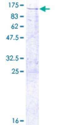 SDS-Page: TRAP1 Recombinant Protein [H00010131-P01]