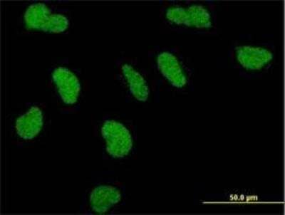 Immunocytochemistry/Immunofluorescence: TRAP220/MED1 Antibody (2A2) [H00005469-M01] - Monoclonal antibody to PPARBP on HeLa cell . [antibody concentration 10 ug/ml]