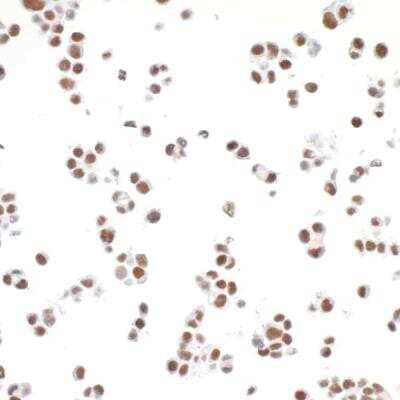 Immunocytochemistry: TRAP220/MED1 Antibody (BLR037F) [NBP2-76407] - Detection of human MED1 in FFPE HCT 116 cells by ICC. Antibody: Rabbit anti-MED1 recombinant monoclonal [BLR037F] (NBP2-76407). Secondary: HRP-conjugated goat anti-rabbit IgG. Substrate: DAB.