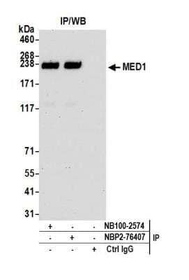 <b>Independent Antibodies Validation. </b>Immunoprecipitation: TRAP220/MED1 Antibody (BLR037F) [NBP2-76407] - Detection of human MED1 by WB of immunoprecipitates from HeLa lysate. Antibodies: Rabbit anti-MED1 recombinant monoclonal [BLR037F] (NBP2-76407) and rabbit anti-MED1 (NB100-2574).