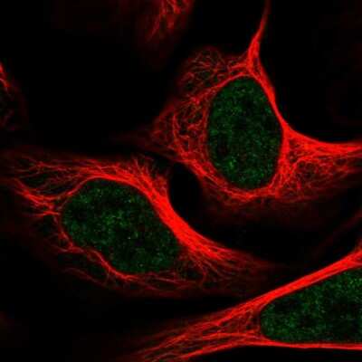 Immunocytochemistry/Immunofluorescence: TRAP220/MED1 Antibody [NBP2-57045] - Staining of human cell line U-2 OS shows localization to nucleoplasm.