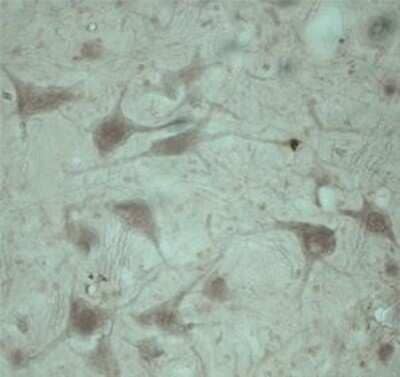 Immunohistochemistry: TRAPPC1 Antibody [NB100-98811] - IHC on rat spinal cord using Rabbit antibody to TPPC1 at 1 : 2000 dilution. Pre-absorption of the antibody with the immunising peptide completely abolishes the immunostaining (not shown).