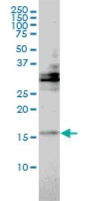 Western Blot: TRAPPC2 Antibody (2E10) [H00006399-M01] - TRAPPC2 monoclonal antibody (M01), clone 2E10 Analysis of TRAPPC2 expression in Hela.