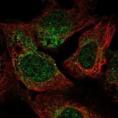 Immunocytochemistry/Immunofluorescence: TRAPPC2 Antibody [NBP2-56481] - Staining of human cell line U-2 OS shows localization to nucleoplasm & endoplasmic reticulum.