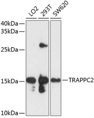 Western Blot: TRAPPC2 Antibody [NBP2-93565] - Analysis of extracts of various cell lines, using TRAPPC2 at 1:1000 dilution. Secondary antibody: HRP Goat Anti-Rabbit IgG (H+L) at 1:10000 dilution. Lysates/proteins: 25ug per lane. Blocking buffer: 3% nonfat dry milk in TBST. Detection: ECL Basic Kit . Exposure time: 5s.