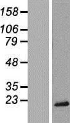 Western Blot: TRAPPC2 Overexpression Lysate (Adult Normal) [NBP2-08785] Left-Empty vector transfected control cell lysate (HEK293 cell lysate); Right -Over-expression Lysate for TRAPPC2.