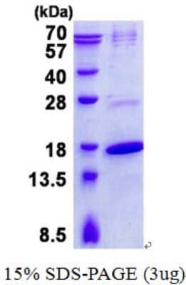 SDS-Page: TRAPPC2 Protein [NBP2-22875]