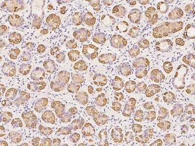 Immunohistochemistry-Paraffin: TRAPPC2L Antibody [NBP2-98640] - Immunochemical staining of human TRAPPC2L in human kidney with rabbit polyclonal antibody at 1:500 dilution, formalin-fixed paraffin embedded sections.