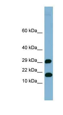 Western Blot: TRAPPC2L Antibody [NBP1-70735] - Human Heart lysate, concentration 0.2-1 ug/ml.