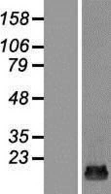 Western Blot: TRAPPC2L Overexpression Lysate (Adult Normal) [NBP2-07072] Left-Empty vector transfected control cell lysate (HEK293 cell lysate); Right -Over-expression Lysate for TRAPPC2L.