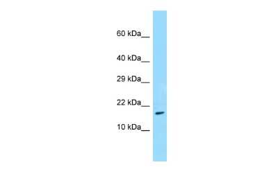 Western Blot: TRAPPC3 Antibody [NBP2-85980] - WB Suggested Anti-TRAPPC3 Antibody. Titration: 1.0 ug/ml. Positive Control: Placenta