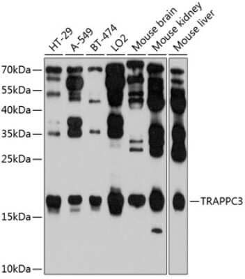Western Blot: TRAPPC3 Antibody [NBP2-93057] - Analysis of extracts of various cell lines, using TRAPPC3 . Exposure time: 60s.