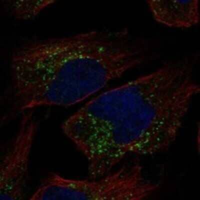 Immunocytochemistry/Immunofluorescence: TRAPPC3L Antibody [NBP3-17182] - Staining of human cell line HeLa shows localization to the Golgi apparatus & vesicles.