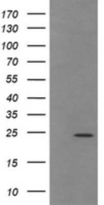 Western Blot: TRAPPC4 Antibody (OTI2G8) - Azide and BSA Free [NBP2-74594] - Analysis of HEK293T cells were transfected with the pCMV6-ENTRY control (Left lane) or pCMV6-ENTRY TRAPPC4.