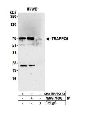 Immunoprecipitation: TRAPPC5 Antibody [NBP2-76386] - Detection of human TRAPPC5 by western blot of immunoprecipitates. Samples: Whole cell lysate (1.0 mg per IP reaction; 20% of IP loaded) from 293T cells prepared using NETN lysis buffer. Antibodies: Affinity purified rabbit anti-TRAPPC5 antibody NBP2-76386 used for IP at 100 ul per reaction. TRAPPC5 was also immunoprecipitated by another rabbit anti-TRAPPC5 antibody. For blotting immunoprecipitated TRAPPC5, NBP2-76386 was used at 1:400. Detection: Chemiluminescence with an exposure time of 30 seconds.
