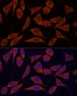 Immunocytochemistry/ Immunofluorescence TRAPPC6A Antibody - Azide and BSA Free