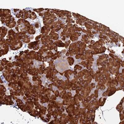 Immunohistochemistry-Paraffin: TRAPPC6A Antibody [NBP1-83167] - Staining of human pancreas shows strong cytoplasmic positivity in exocrine glandular cells.