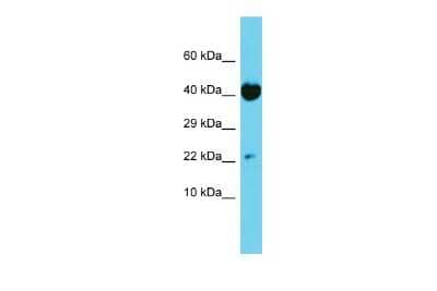 Western Blot: TRAPPC6A Antibody [NBP2-83712] - Host: Rabbit. Target Name: TRAPPC6A. Sample Type: HT1080 Whole Cell lysates. Antibody Dilution: 1.0ug/ml