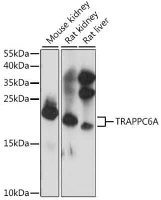 Western Blot TRAPPC6A Antibody - Azide and BSA Free